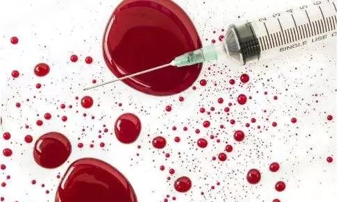 1571640082536305.jpg 640.webp.jpg