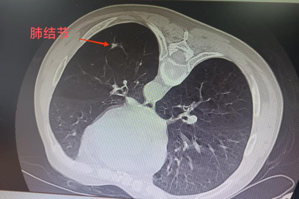 1692332949702544.png 1.png