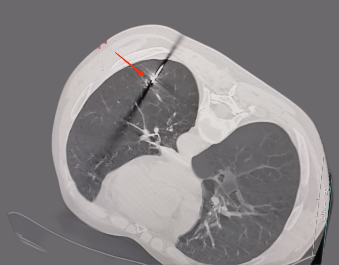 1692333030792001.png 3.png