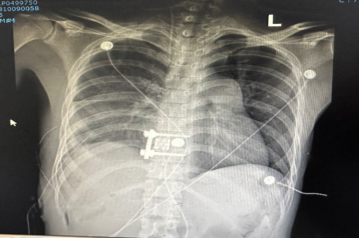 1697772802297362.png 2.png