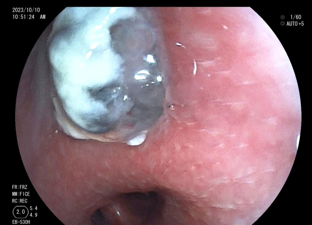 1702994179889933.png 1.png