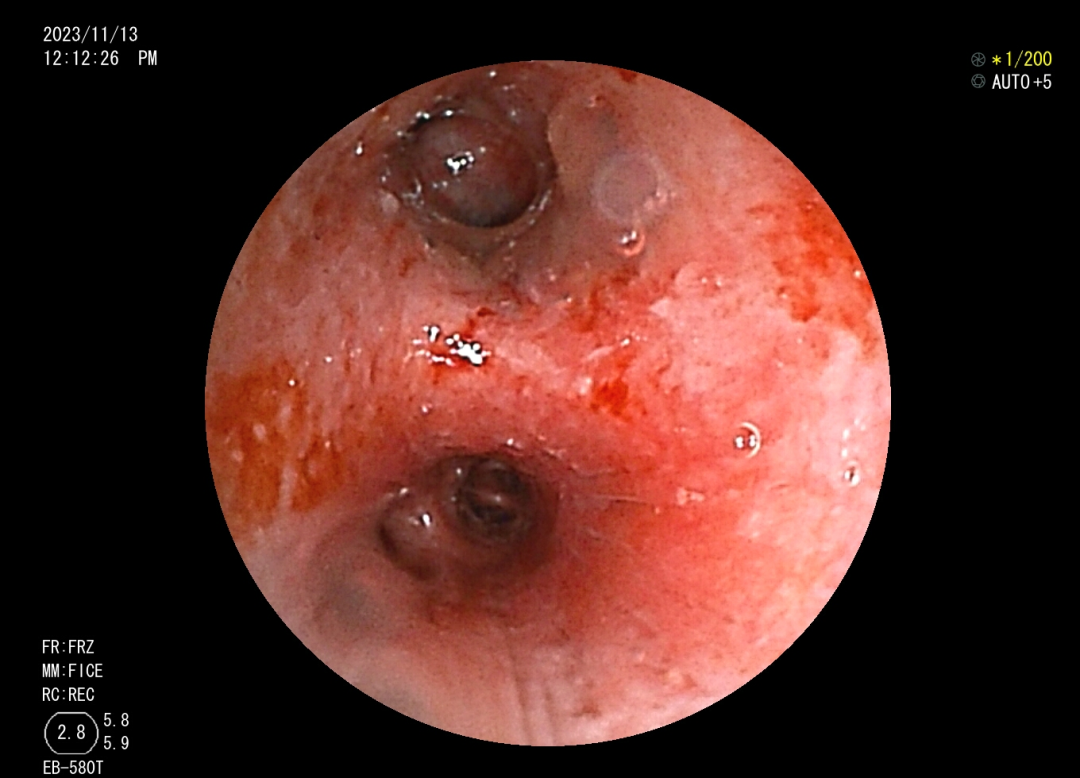 1702994187661215.png 2.png