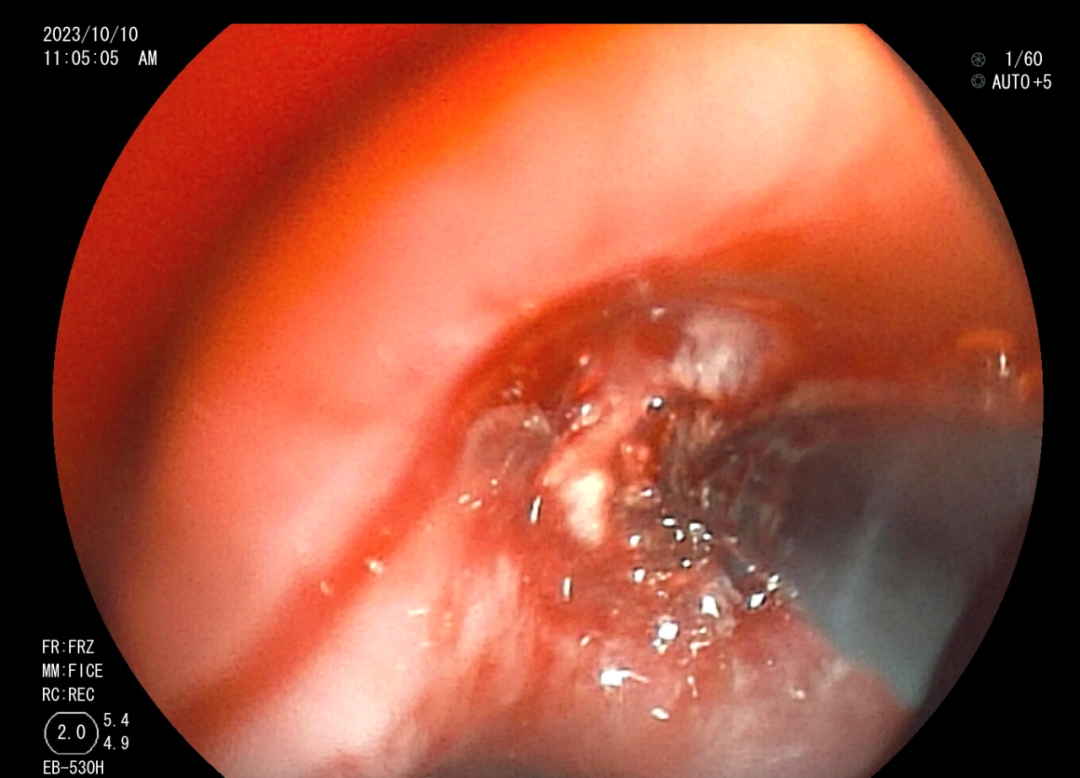 1702994195254655.png 3.png