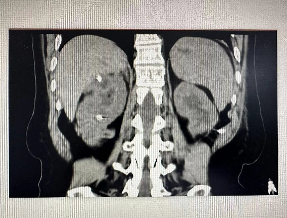 1706871855934058.png 2.png