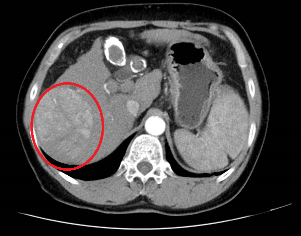 1711088280360578.png 1.png