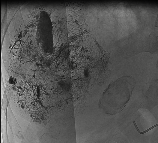 1711088340347976.png 6.png