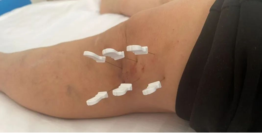 1741962531396447.png 2.png